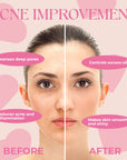 Turmeric Foaming Facial Cleanser Turmeric & Kojic Acid